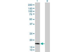 Western Blot analysis of CALML5 expression in transfected 293T cell line by CALML5 MaxPab polyclonal antibody. (CALML5 anticorps  (AA 1-146))