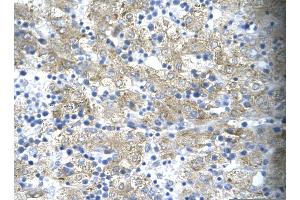 Rabbit Anti-TAL1 Antibody       Paraffin Embedded Tissue:  Human hepatocyte cell   Cellular Data:  Epithelial cells of renal tubule  Antibody Concentration:   4.