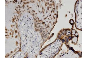 anti-Casein Kinase 1, delta (CSNK1D) (AA 301-415) antibody