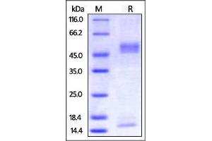 Biotinylated Mouse FcRn / FCGRT & B2M on SDS-PAGE under reducing (R) condition.