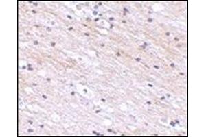 Immunohistochemistry of SATB1 in human brain tissue with this product at 2. (SATB1 anticorps  (N-Term))