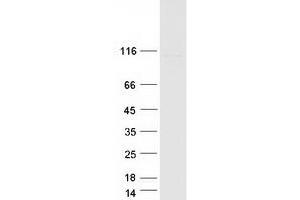 Validation with Western Blot