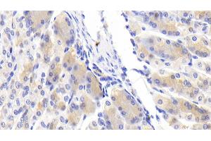 Detection of Slit3 in Mouse Stomach Tissue using Polyclonal Antibody to Slit Homolog 3 (Slit3)
