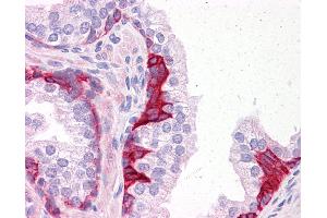 Anti-PIAS3 antibody IHC of human prostate.