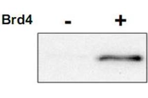 Western blot using CDK9 (phospho T29) polyclonal antibody  shows detection of phospho-CDK9. (CDK9 anticorps  (pThr29))