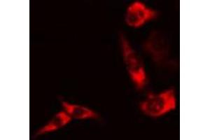 ABIN6267681 staining 293 cells by IF/ICC.