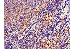 Immunohistochemistry of paraffin-embedded human lymph node tissue using ABIN7152706 at dilution of 1:100 (FERMT3 anticorps  (AA 388-503))