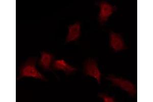 ABIN6276021 staining NIH-3T3 by IF/ICC. (GPR173 anticorps  (Internal Region))
