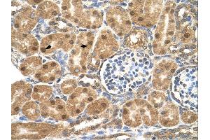 Immunohistochemistry (IHC) image for anti-Prostaglandin D2 Synthase (PTGDS) (N-Term) antibody (ABIN2783248)
