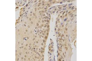 Immunohistochemistry (IHC) image for anti-BMI1 Polycomb Ring Finger Oncogene (BMI1) (AA 120-326) antibody (ABIN3020691)