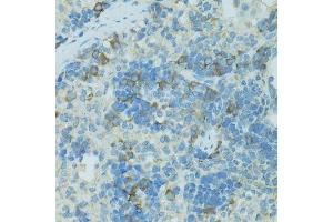 Immunohistochemistry of paraffin-embedded rat spleen using TJP2 antibody.