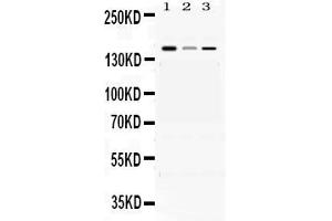 Western blot analysis of ADAMTS13 expression in rat brain extract ( Lane 1), mouse liver extract ( Lane 2) and HEPG2 whole cell lysates ( Lane 3).