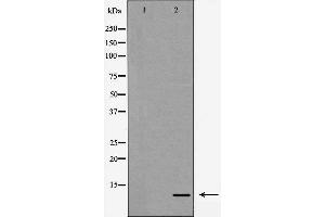 Western blot analysis of Interleukin 8 expression in HeLa cells,,The lane on the left is treated with the antigen-specific peptide. (IL-8 anticorps  (Internal Region))
