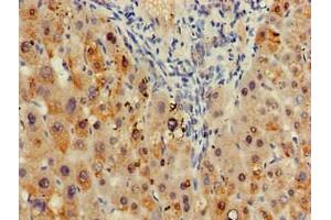 Immunohistochemistry of paraffin-embedded human liver tissue using ABIN7171273 at dilution of 1:100
