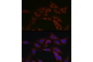 Immunofluorescence analysis of NIH/3T3 cells using  Rabbit pAb (ABIN6129847, ABIN6136332, ABIN6136333 and ABIN6223063) at dilution of 1:100 (40x lens).