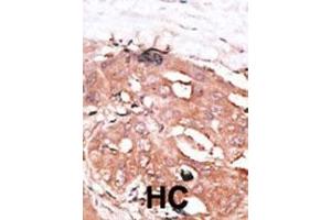 anti-Autophagy related 4D Cysteine Peptidase (ATG4D) (AA 14-43), (N-Term) antibody