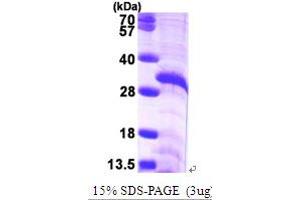SDS-PAGE (SDS) image for Fibrillarin (FBL) (AA 83-321) protein (His tag) (ABIN5852913)