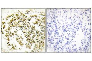 Immunohistochemistry analysis of paraffin-embedded human lymph node tissue using Musculin antibody. (Musculin anticorps  (C-Term))