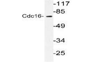 Western blot analysis of CDC16 in extracts from HuvEc cells using CDC16 / APC6 antibody (CDC16 anticorps)