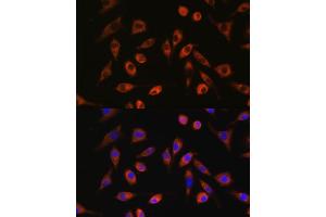 Immunofluorescence analysis of L929 cells using TP53I13 antibody (ABIN7271098) at dilution of 1:100. (TP53I13 anticorps  (AA 180-310))