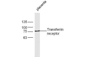 Mouse placenta lysates probed with Rabbit Anti-Transferrin receptor Polyclonal Antibody, Unconjugated  at 1:500 for 90 min at 37˚C (Transferrin Receptor anticorps  (AA 621-720))