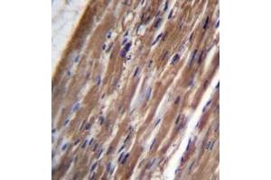 Immunohistochemistry analysis in formalin fixed and paraffin embedded human heart tissue reacted with FBLIM1 Antibody (C-term) followed by peroxidase conjugation of the secondary antibody and DAB staining. (FBLIM1 anticorps  (C-Term))
