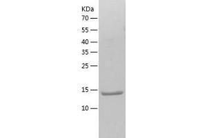 Bromodomain Containing 4 (BRD4) (AA 49-170) protein (His tag)