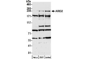 Western Blotting (WB) image for anti-AT Rich Interactive Domain 2 (ARID, RFX-Like) (ARID2) (AA 1785-1835) antibody (ABIN7453593)