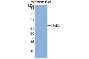 Western blot analysis of the recombinant protein. (IL2 Receptor beta anticorps  (AA 27-239))