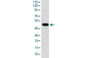 Western blot analysis of human TUBE1 (AA: 314-472) recombinant protein (Expected MW is 44.