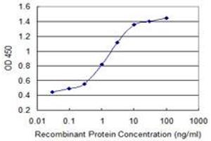 Detection limit for recombinant GST tagged CABP4 is 0.