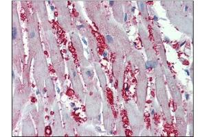 Human Heart: Formalin-Fixed, Paraffin-Embedded (FFPE) (alpha 1 Adrenergic Receptor anticorps  (AA 206-270))