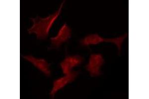 ABIN6275389 staining MCF7 by IF/ICC.