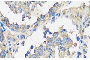 Immunohistochemistry of paraffin-embedded Mouse testis using ASZ1 Polyclonal Antibody at dilution of 1:100 (40x lens). (ASZ1 anticorps)