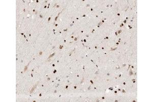 ABIN6266649 at 1/100 staining human brain tissue sections by IHC-P. (UBR5 anticorps  (N-Term))