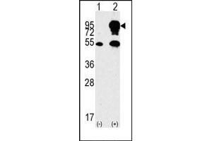 Image no. 1 for anti-B-Raf proto-oncogene, serine/threonine kinase (BRAF) (Middle Region) antibody (ABIN360129) (BRAF anticorps  (Middle Region))