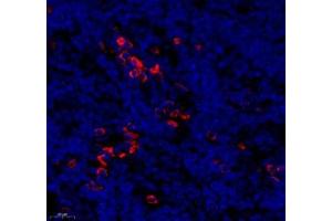 Immunofluorescence of paraffin embedded rat lymph node using MS4A2 (ABIN7074594) at dilution of 1: 400 (500x lens)