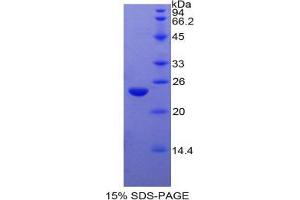SDS-PAGE analysis of Cow PPARG Protein. (PPARG Protéine)