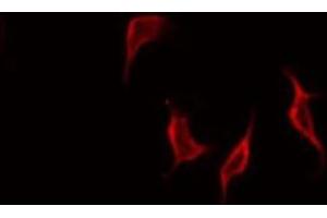 ABIN6268776 staining HepG2 by IF/ICC.