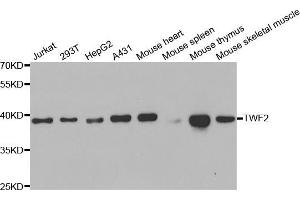 Western blot analysis of extracts of various cell lines, using TWF2 antibody (ABIN5973471) at 1/1000 dilution. (TWF2 anticorps)