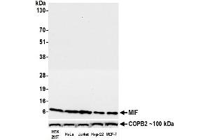 Western Blotting (WB) image for anti-Macrophage Migration Inhibitory Factor (Glycosylation-Inhibiting Factor) (MIF) (AA 2-115) antibody (ABIN7449528)