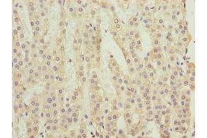 Immunohistochemistry of paraffin-embedded human adrenal gland tissue using ABIN7174836 at dilution of 1:100 (C3orf18 anticorps  (AA 83-162))