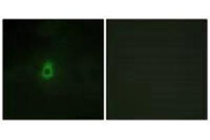 Immunofluorescence analysis of HepG2 cells, using Cytochrome P450 2E1 antibody.