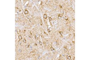 Immunohistochemistry of paraffin-embedded rat brain using NDUFB9 Rabbit mAb (ABIN7268815) at dilution of 1:200 (40x lens). (NDUFB9 anticorps)