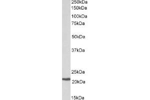 ABIN1590018 (0. (CBFB anticorps  (Internal Region))
