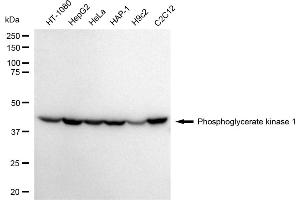 Western blotting analysis using Phosphoglycerate kinase 1 antibody (ABIN7799809).
