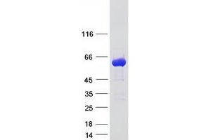 Validation with Western Blot