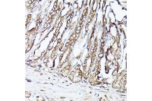 Immunohistochemistry of paraffin-embedded mouse stomach using MLST8 Rabbit pAb (ABIN6131371, ABIN6143894, ABIN6143895 and ABIN6217660) at dilution of 1:100 (40x lens).