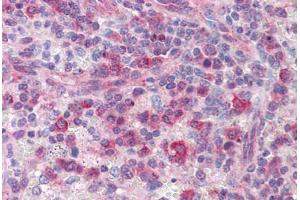 Human Spleen: Formalin-Fixed, Paraffin-Embedded (FFPE)