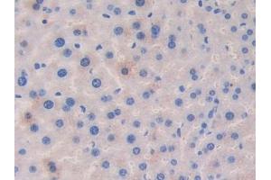 Detection of LAMa4 in Mouse Liver Tissue using Polyclonal Antibody to Laminin Alpha 4 (LAMa4)